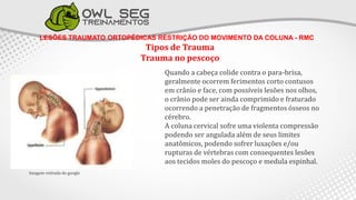 LESÕES TRAUMATO ORTOPÉDICAS RESTRIÇÃO DO MOVIMENTO DA COLUNA - RMC
Tipos de Trauma
Trauma no pescoço
Quando a cabeça colide contra o para-brisa,
geralmente ocorrem ferimentos corto contusos
em crânio e face, com possíveis lesões nos olhos,
o crânio pode ser ainda comprimido e fraturado
ocorrendo a penetração de fragmentos ósseos no
cérebro.
A coluna cervical sofre uma violenta compressão
podendo ser angulada além de seus limites
anatômicos, podendo sofrer luxações e/ou
rupturas de vértebras com consequentes lesões
aos tecidos moles do pescoço e medula espinhal.
Imagem retirada do google
 