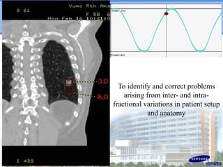 To identify and correct problems
arising from inter- and intrafractional variations in patient setup
and anatomy

 