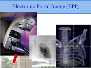 Electronic Portal Image (EPI)

 
