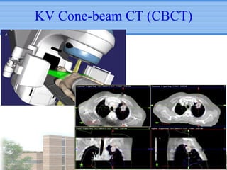 KV Cone-beam CT (CBCT)

 