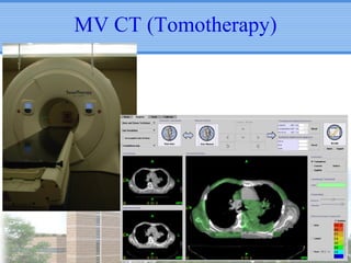 MV CT (Tomotherapy)

 