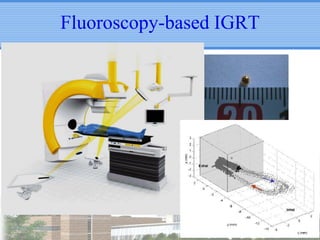 Fluoroscopy-based IGRT

 