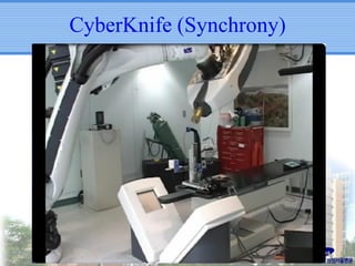 CyberKnife (Synchrony)

 