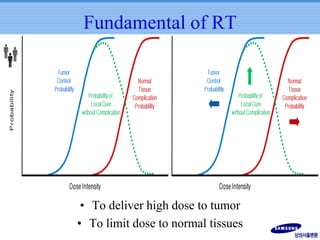 Fundamental of RT

• To deliver high dose to tumor
• To limit dose to normal tissues

 