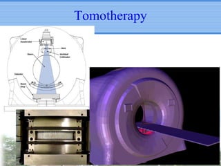 Tomotherapy

 