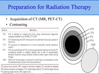 Preparation for Radiation Therapy
• Acquisition of CT (MR, PET-CT)
• Contouring

 
