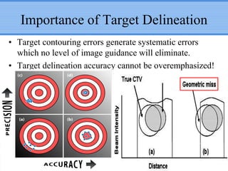 Importance of Target Delineation
• Target contouring errors generate systematic errors
which no level of image guidance will eliminate.
• Target delineation accuracy cannot be overemphasized!

 