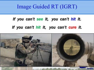 Image Guided RT (IGRT)
If you can’t see it, you can’t hit it.

If you can’t hit it, you can’t cure it.

 