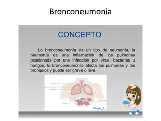Bronconeumonia
 