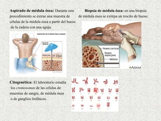 Aspirado de médula ósea: Durante este Biopsia de médula ósea: en una biopsia
procedimiento se extrae una muestra de de médula ósea se extirpa un trocito de hueso.
células de la médula ósea a partir del hueso
de la cadera con una aguja.
Citogenética: El laboratorio estudia
los cromosomas de las células de
muestras de sangre, de médula ósea
o de ganglios linfáticos.
 