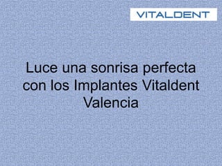 Luce una sonrisa perfecta
con los Implantes Vitaldent
Valencia
 