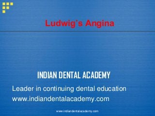 Ludwig’s Angina

INDIAN DENTAL ACADEMY
Leader in continuing dental education
www.indiandentalacademy.com
www.indiandentalacademy.com

 