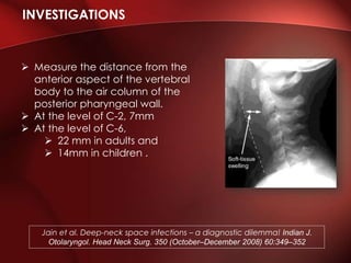 INVESTIGATIONS
 Measure the distance from the
anterior aspect of the vertebral
body to the air column of the
posterior pharyngeal wall.
 At the level of C-2, 7mm
 At the level of C-6,
 22 mm in adults and
 14mm in children .
Jain et al. Deep-neck space infections – a diagnostic dilemma! Indian J.
Otolaryngol. Head Neck Surg. 350 (October–December 2008) 60:349–352
 