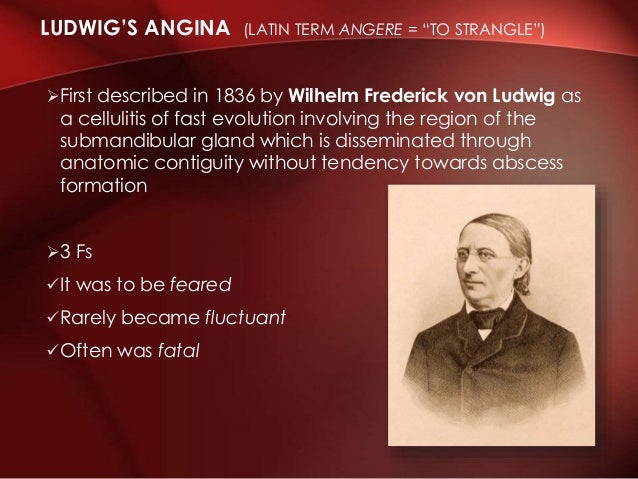 ludwig s angina