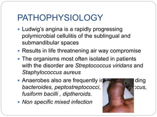 Ludwigs angina | PPTX