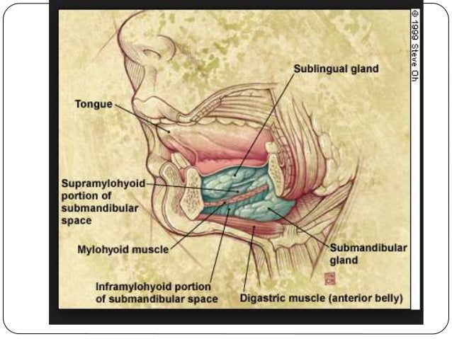 ludwig s angina