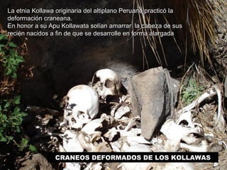 La etnia Kollawa originaria del altiplano PPeerruuaannoo pprraaccttiiccóó llaa 
ddeeffoorrmmaacciióónn ccrraanneeaannaa.. 
EEnn hhoonnoorr aa ssuu AAppuu KKoollllaawwaattaa ssoollííaann aammaarrrraarr llaa ccaabbeezzaa ddee ssuuss 
rreecciiéénn nnaacciiddooss aa ffiinn ddee qquuee ssee ddeessaarrrroollllee eenn ffoorrmmaa aallaarrggaaddaa 
CRANEOS DEFORMADOS DE LOS KOLLAWAS 
 