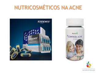 NUTRICOSMÉTICOS NA ACNE
 
