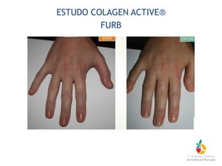 ESTUDO COLAGEN ACTIVE®
FURB
 