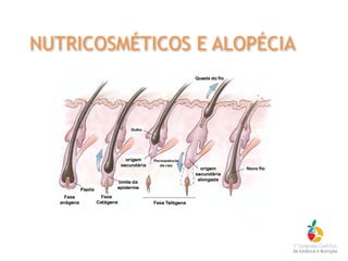 NUTRICOSMÉTICOS E ALOPÉCIA
 