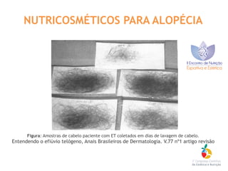 NUTRICOSMÉTICOS PARA ALOPÉCIA
Figura: Amostras de cabelo paciente com ET coletados em dias de lavagem de cabelo.
Entendendo o efiúvio telógeno, Anais Brasileiros de Dermatologia. V.77 nº1 artigo revisão
 
