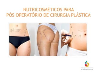 NUTRICOSMÉTICOS PARA
PÓS OPERATÓRIO DE CIRURGIA PLÁSTICA
 