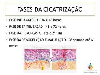 FASES DA CICATRIZAÇÃO
• FASE INFLAMATÓRIA – 36 a 48 horas
• FASE DE EPITELIZAÇÃO – 48 a 72 horas
• FASE DA FIBROPLASIA – até o 21º dia
• FASE DA REMODELAÇÃO E MATURAÇÃO – 3ª semana até 6
meses
 
