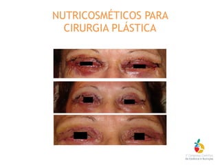 NUTRICOSMÉTICOS PARA
CIRURGIA PLÁSTICA
 