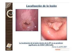 Localización de la lesión




      La localización de la lesión dentro de la ZT es un predictor
                   significativo de CIN2+ (OR: 8,60).
                                                   Hames LS, JLGTD 2007
GMV
 