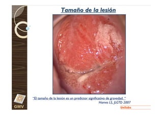 Tamaño de la lesión




      “El tamaño de la lesión es un predictor significativo de gravedad. “
                                                       Hames LS, JLGTD 2007
GMV
 