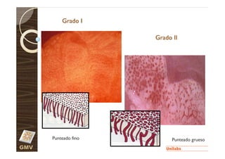Grado I

                      Grado II




      Punteado fino         Punteado grueso
GMV
 