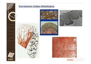 Correlación Colpo-Histológica




GMV
 