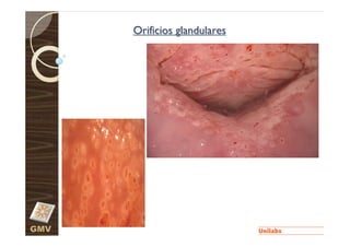 Orificios glandulares




GMV
 