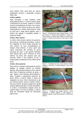 Anatomia Arterial e Venosa Aplicada                            Luiz Carlos Gusmão


nervo safeno. Este canal deve ser aberto
amplamente durante a exploração cirúrgica
deste vaso.
Artéria poplítea
Após atravessar o hiato tendíneo, fenda
musculoaponeurótica, 3 a artéria femoral passa
a denominar-se de artéria poplítea. A artéria
situa-se profundamente em todo o seu trajeto.
Finalmente, esta artéria divide-se em artéria
tibial posterior e artéria tibial anterior. Como
se situa sob a tensa fáscia poplítea, para a
artéria ser palpada é necessário manter o                     Figura 1 – Fotografia dos vasos retroperitoneais: 1. Veia
joelho em flexão.                                             cava inferior; 2. Artéria aorta abdominal; 3. Ureter; 4.
                                                              Tronco celíaco; 5. Artéria ilíaca comum; 6. Artéria ilíaca
Artéria tibial anterior                                       externa; 7. Artéria ilíaca interna; 8. Veia renal; 9. Vasos
                                                              lienais.
A artéria tibial anterior perfura de posterior
para anterior a membrana interóssea, e desce,
em companhia do nervo fibular profundo, na
face anterior da coxa, profundamente ao
músculo tibial anterior. A maior parte dos
ramos musculares são emitidos na parte
proximais do vaso, 4 o que permite mobilizar
este músculo para cobrir defeitos no terço
inferior da perna sem prejuízo para sua
nutrição. Sobre a face superior do pé, a
artéria passa a denominar-se de artéria dorsal
do pé.
Artéria tibial posterior                                      Figura 2 – Fotografia da axila e braço direiro: 1. Nervo
                                                              mediano; 2. Veia axilar; 3. Artéria braquial; 4. Veia axilar
Esta artéria é a própria continuação da artéria               acessória.
poplítea na margem inferior do músculo
poplíteo. Desce posteriormente à tíbia coberta
pela fáscia transversa profunda da perna, a
qual separa-a dos músculos gastrocnêmios e
sóleo, irrigando a musculatura posterior da
perna. Emite a artéria fibular e desce em
companhia do nervo tibial dividindo-se no pé
em artérias plantar lateral e plantar medial.
No terço inferior da perna é superficial, sendo
coberta apenas pela pele e tecido subcutâneo.
A artéria é normalmente palpada atrás do
maléolo medial. Ao nível do maléolo, a artéria
                                                              Figura 3 – Fotografia das regiões femoral e ilíaca
pode ser facilmente lesada em ferimentos
                                                              esquerdas: 1. Artéria femoral; 2. Veia femoral; 3.
superficiais.                                                 Ligamento inguinal; 4. Veia ilíaca externa; 5. Artéria ilíaca
                                                              externa.




                                                    16/05/2003                                             Página 5 de 9
             Pitta GBB, Castro AA, Burihan E, editores. Angiologia e cirurgia vascular: guia ilustrado.
            Maceió: UNCISAL/ECMAL & LAVA; 2003. Disponível em: URL:http://www. lava.med.br/livro
 