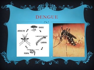 DENGUE
 