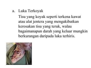 Luka Terkoyak Tisu yang koyak seperti terkena kawat atau alat jentera yang mengakibatkan kerosakan tisu yang teruk, walau bagaimanapun darah yang keluar mungkin berkurangan daripada luka terhiris. 