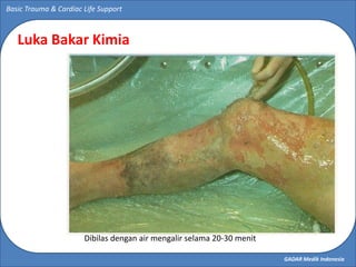 GADAR Medik Indonesia
Basic Trauma & Cardiac Life Support
Luka Bakar Kimia
Dibilas dengan air mengalir selama 20-30 menit
 
