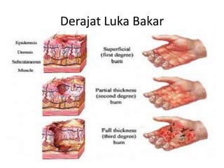 LUKA BAKAR.pptx