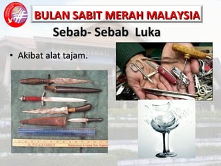 Sebab- Sebab  Luka Akibat alat tajam. 