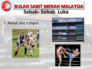 Sebab- Sebab  Luka Akibat alat tumpul. 