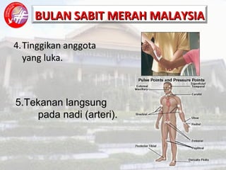 4. Tinggikan anggota  yang luka. 5. Tekanan langsung  pada nadi (arteri). 