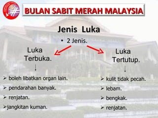 Jenis  Luka 2 Jenis. Luka Terbuka. Luka Tertutup. kulit tidak pecah. lebam. bengkak. renjatan. boleh libatkan organ lain. pendarahan banyak. renjatan. jangkitan kuman. 