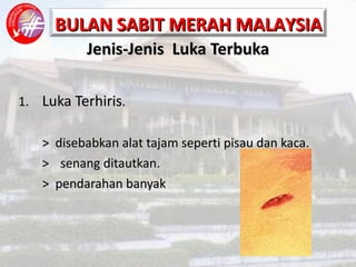 Jenis-Jenis  Luka Terbuka 1. Luka Terhiris . >  disebabkan alat tajam seperti pisau dan kaca. >   senang ditautkan. >  pendarahan banyak 