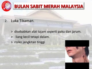 2. Luka Tikaman . >  disebabkan alat tajam seperti paku dan jarum. >   liang kecil tetapi dalam. >  risiko jangkitan tinggi 