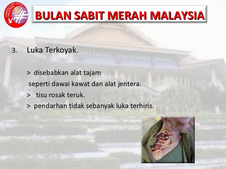 Luka dan pendarahan