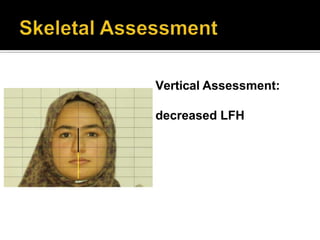 Vertical Assessment:
decreased LFH
 