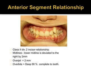 Class II div. 2 incisor relationship
Midlines : lower midline is deviated to the
right by 2mm
Overjet = 2 mm
Overbite = Deep 90 % complete to tooth.
 