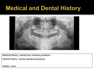 Medical History: denied any medical problems.
Dental History: routine dental procedures.
Habits: none.
 