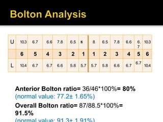 Anterior Bolton ratio= 36/46*100%= 80%
(normal value: 77.2± 1.65%)
Overall Bolton ratio= 87/88.5*100%=
91.5%
U 10.3 6.7 6.6 7.8 6.5 8 8 6.5 7.8 6.6 6.
7
10.3
6 5 4 3 2 1 1 2 3 4 5 6
L 10.4 6.7 6.7 6.6 5.8 5.7 5.7 5.8 6.6 6.7
6.7
10.4
 