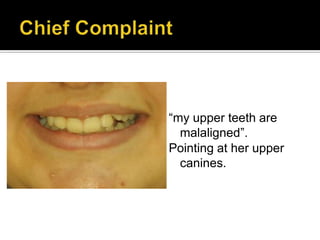 “my upper teeth are
malaligned”.
Pointing at her upper
canines.
 